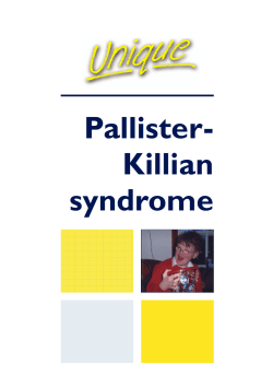 Killian syndrome