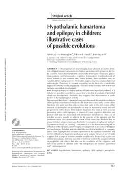Hypothalamic hamartoma and epilepsy in children: illustrative cases