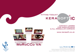 Fitting Toolkit Example - Decentred