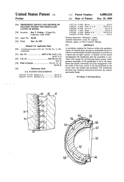 Prosthetic device and method of fixation within the medullary cavity