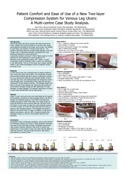 Patient Comfort and Ease of Use of a New Two