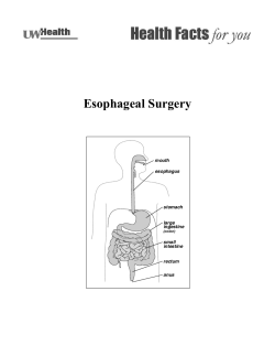 Esophageal Surgery