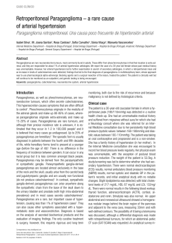Retroperitoneal Paraganglioma &ndash; a rare cause of arterial hypertension