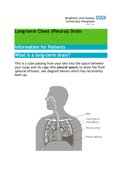 (Pleural) Drain - Brighton and Sussex University Hospitals NHS Trust