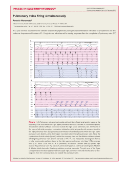 Pulmonary veins firing simultaneously