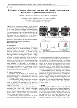 Dysfunction of postural adjustments associated with voluntary