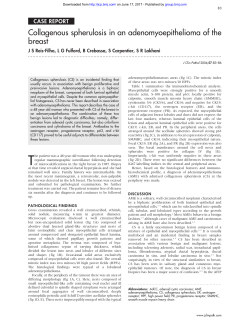 Collagenous spherulosis in an adenomyoepithelioma of the breast