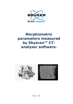 here - Bruker microCT