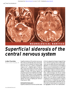 Superficial siderosis of the central nervous system