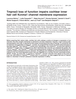 Tmprss3 loss of function impairs cochlear inner hair cell Kcnma1