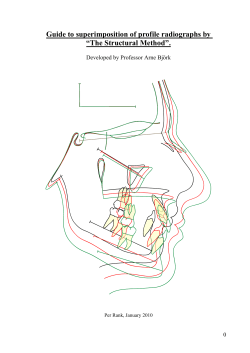 Guide to superimposition of profile radiographs by