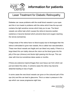 Laser Treatment for Diabetic Retinopathy Feb 2017