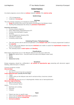 Ectopic Pregnancy