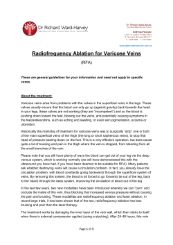 Radiofrequency Ablation for Varicose Veins