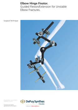 Elbow Hinge Fixator. Guided Flexion/Extension for Unstable Elbow