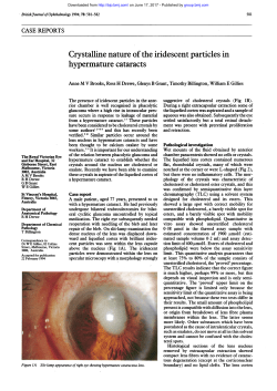 Crystalline nature of the iridescent particles in hypermature cataracts