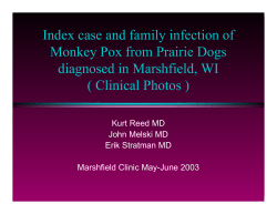 Index case and family infection of Monkey Pox from
