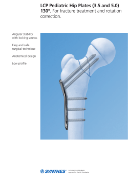 LCP Pediatric Hip Plates (3.5 and 5.0) 130&deg;. For fracture treatment