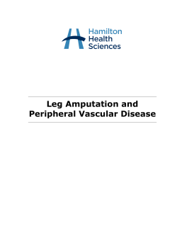 Leg Amputation And Peripheral Vascular Disease