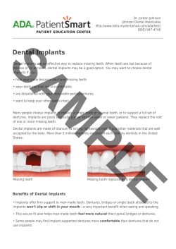 ADA Patient Smart | Dental Implants