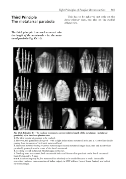 Third Principle The metatarsal parabola