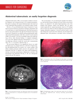 Abdominal tuberculosis: an easily forgotten diagnosis