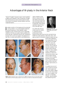 Advantages of W-plasty in the Anterior Neck