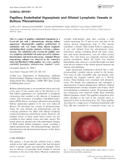 Papillary Endothelial Hyperplasia and Dilated Lymphatic Vessels in