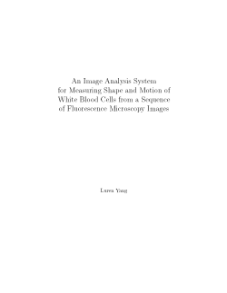 An image analysis system for measuring shape and motion of white