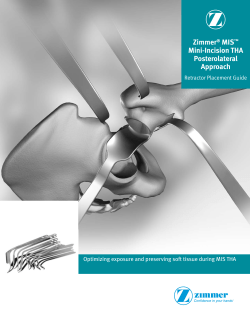 1001-87-032 Zimmer_MIS_Mini