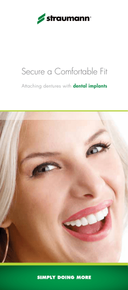 Attaching Dentures with Dental Implants