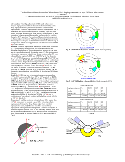 The Positions of Bony Protrusion Where Bone