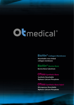 BioVin&reg;Bovine Bone BioVin&reg;Collagen Membrane OTossSynthetic