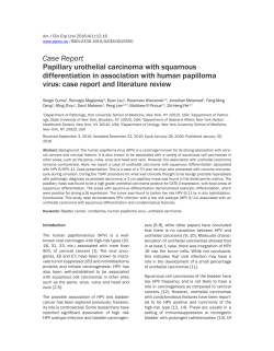 Case Report Papillary urothelial carcinoma with squamous