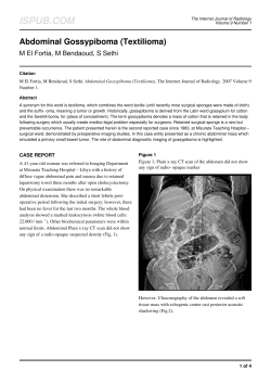 Abdominal Gossypiboma (Textilioma)