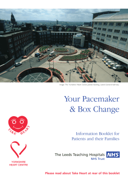 Your Pacemaker and Box Change - Leeds Teaching Hospitals NHS