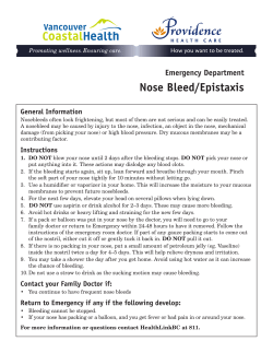 Nosebleed - Epistaxis (ER)