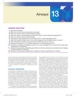Airways