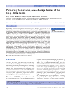 Pulmonary hamartoma, a rare benign tumour of the lung &ndash; Case series