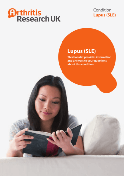 Lupus (SLE)