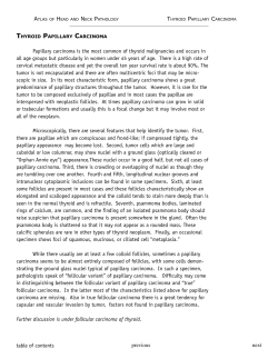 Thyroid Papillary Carcinoma