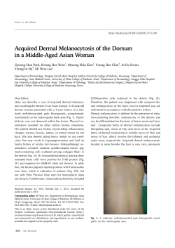 Acquired Dermal Melanocytosis of the Dorsum in a Middle