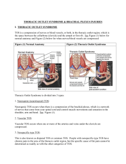 THORACIC OUTLET SYNDROME