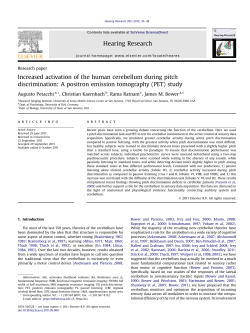 Increased activation of the human cerebellum during pitch