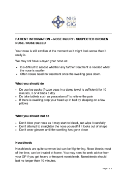 Nose injury - NHS Direct Wales