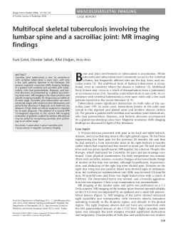 Multifocal skeletal tuberculosis involving the lumbar spine and a