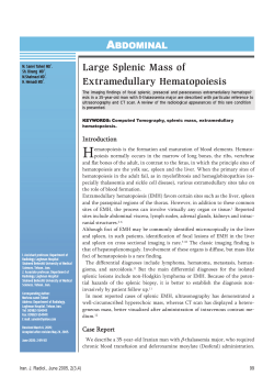 Large Splenic Mass of Extramedullary Hematopoiesis