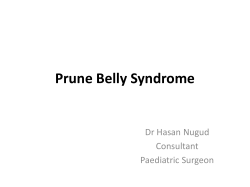 Prune Belly Syndrome
