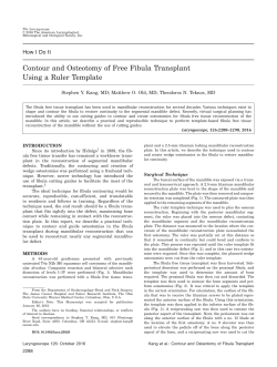 Contour and osteotomy of free fibula transplant using a ruler template