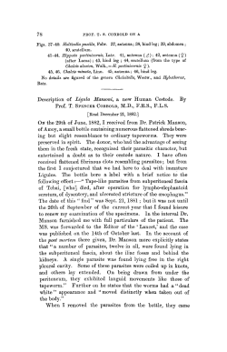 Description of Ligula Mansoni, a new Human Cestode.